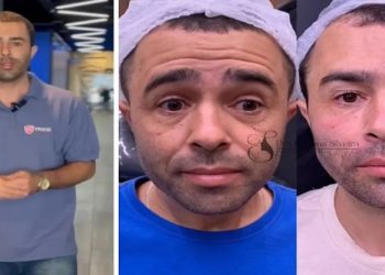 Motorista que atropelou Kayky Brito vira influenciador, faz 'publi' e até harmonização