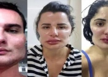 Médico é condenado à prisão após deformar o rosto de pelo menos nove pacientes