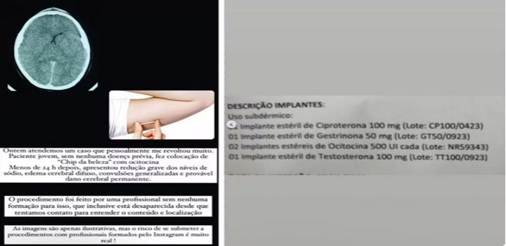 chipa da beleza com ocitocina