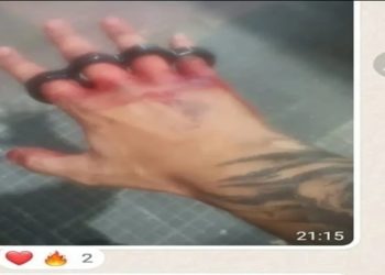 ‘Justiceiros’ compartilham fotos das mãos ensanguentadas e com soco-inglês