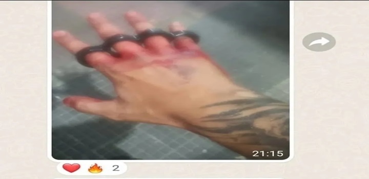 ‘Justiceiros’ compartilham fotos das mãos ensanguentadas e com soco-inglês