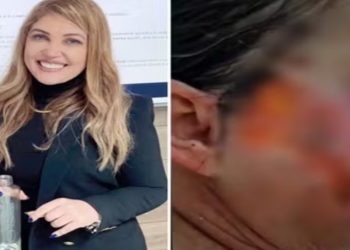 Presa dentista suspeita de atuar como médica e deformar pacientes em cirurgias estéticas