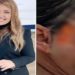 Presa dentista suspeita de atuar como médica e deformar pacientes em cirurgias estéticas