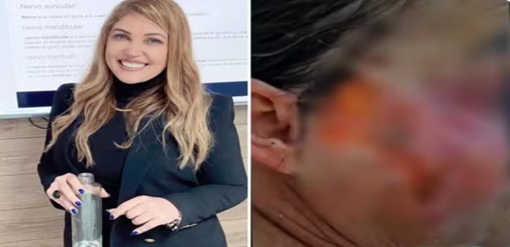 Presa dentista suspeita de atuar como médica e deformar pacientes em cirurgias estéticas