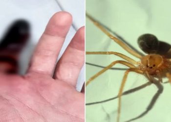 homem picado por aranha
