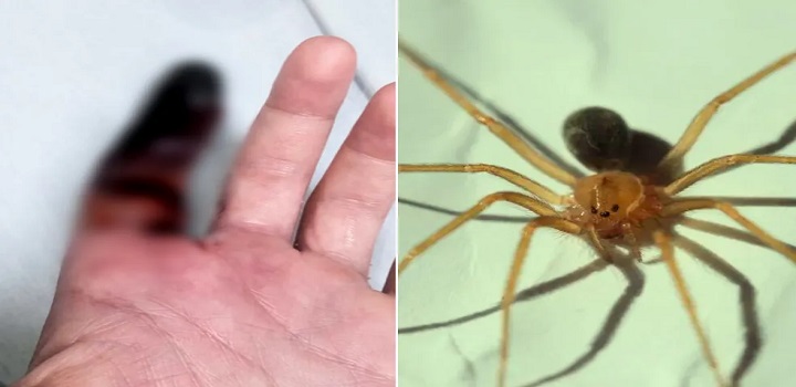 homem picado por aranha