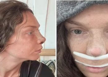 Cirurgia plástica ajudou a acusada do assassinato de ciclista a permanecer fugitiva; veja imagens