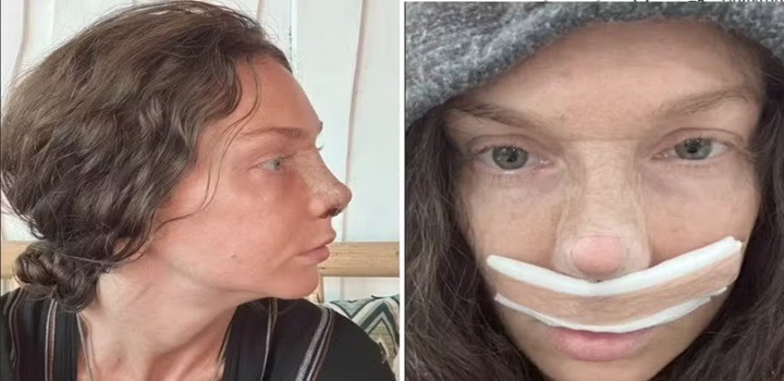 Cirurgia plástica ajudou a acusada do assassinato de ciclista a permanecer fugitiva; veja imagens