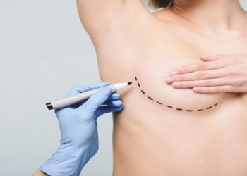 avanços da mamoplastia