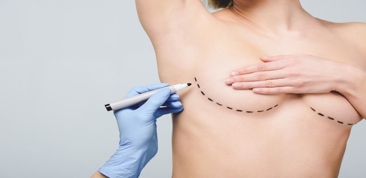avanços da mamoplastia