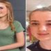 Menina de 13 anos quase fica cega por dica de beleza que viu no TikTok