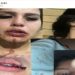 Geovana Pontes, influenciadora de 19 anos, denuncia um grupo de influenciadores por ameaça, lesão corporal, cárcere privado e abuso sexual