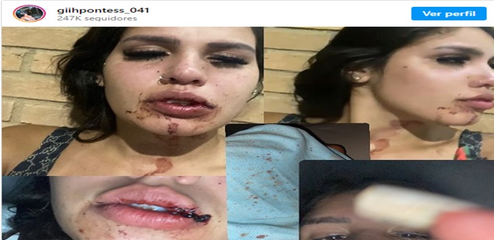 Geovana Pontes, influenciadora de 19 anos, denuncia um grupo de influenciadores por ameaça, lesão corporal, cárcere privado e abuso sexual