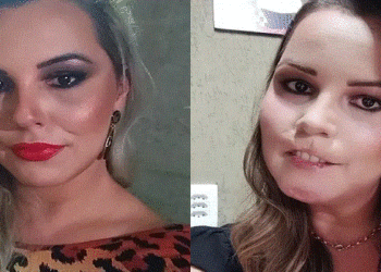 mulher perde labio