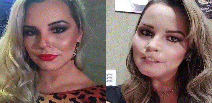 mulher perde labio
