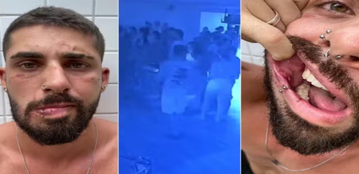 Instrutor de dança é espancado após apresentação em bar: 'quero ver rebolar agora', disse agressor;
