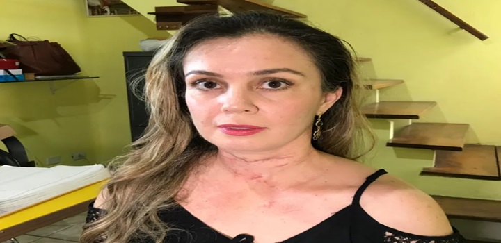 mulher esfaqueada mais de 70 vezes pelo ex