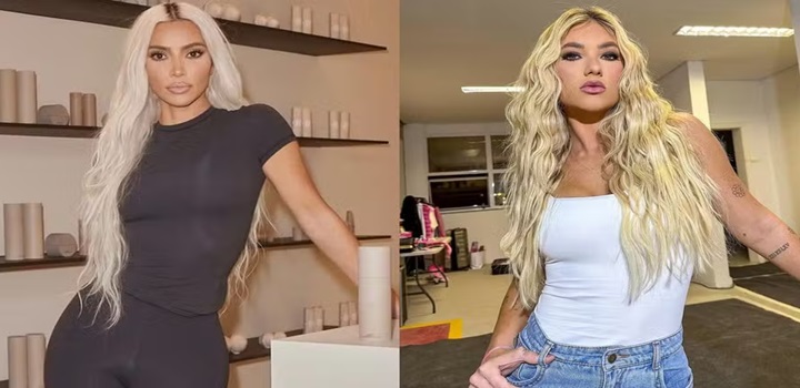 Beleza das famosas: Kim Kardashian e Virgínia Fonseca são adeptas do 'tratamento mais doloroso do mundo'; conheça