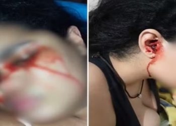 jovem que chora sangue
