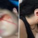 jovem que chora sangue