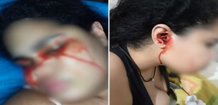 jovem que chora sangue