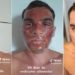 peeling de fenol a venda na internet