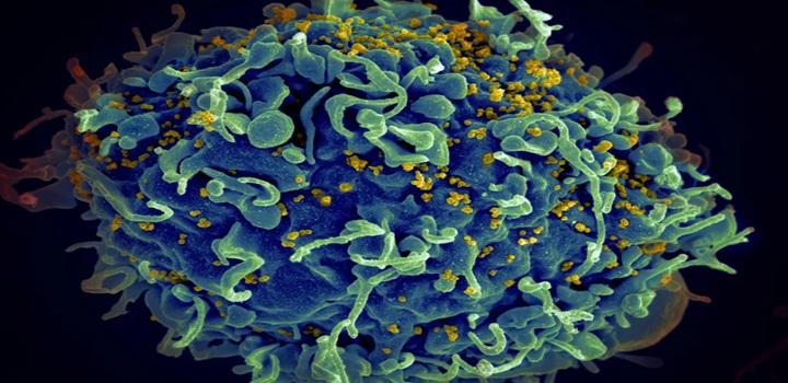 cientistas anunciam paciente curado da aids