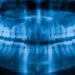 IA brasileira identifica sexo a partir de raio-X dentário