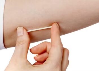 anvisa proibe chip da beleza