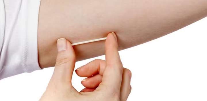 anvisa proibe chip da beleza