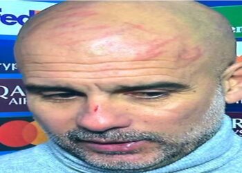 guardiola machucado