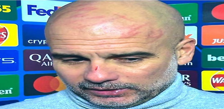 guardiola machucado