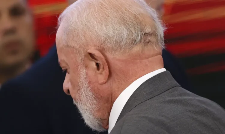 cirurgia de lula