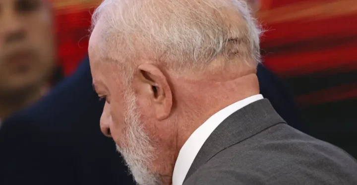 cirurgia de lula