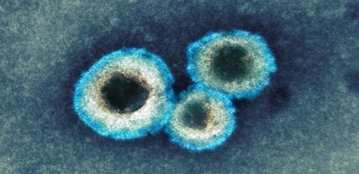 METAPNEUMOVIRUS HUMANO