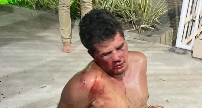 Morador filmado ao matar subsíndico em prédio na cidade de Campos-RJ