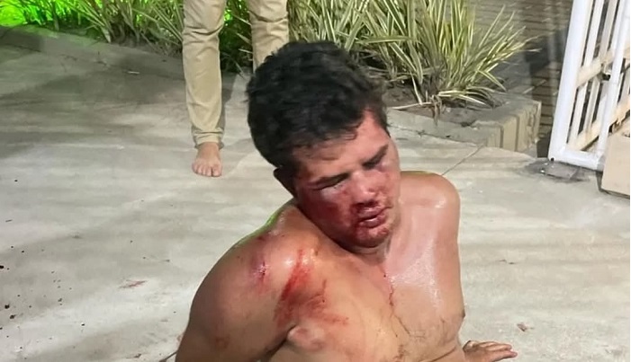 Morador filmado ao matar subsíndico em prédio na cidade de Campos-RJ