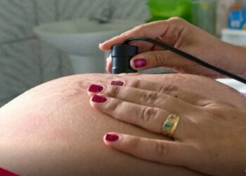 Saúde recomenda cálcio para todas as gestantes para prevenir eclâmpsia