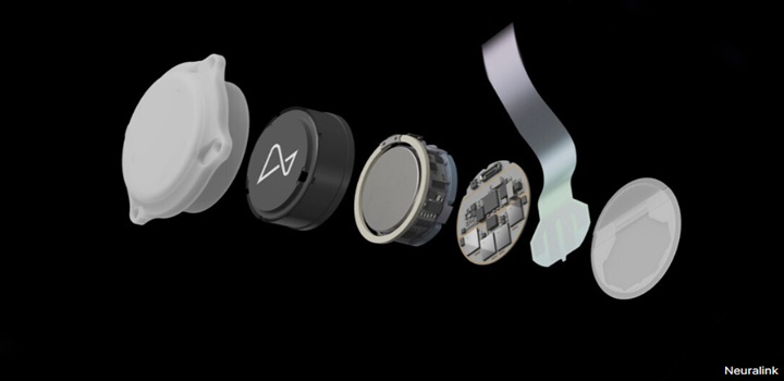 Neuralink implantará dispositivo que supera a cegueira completa