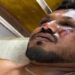 sobrevivente acidente india