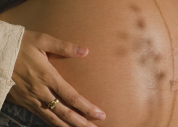 Estudo aponta que a ausência de pré-natal aumenta em quase 50% o risco de anomalias graves em recém-nascidos e compromete a saúde materna.