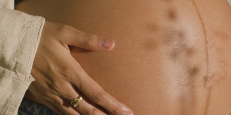 Estudo aponta que a ausência de pré-natal aumenta em quase 50% o risco de anomalias graves em recém-nascidos e compromete a saúde materna.