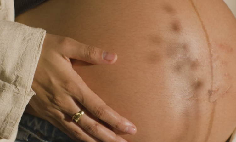 Estudo aponta que a ausência de pré-natal aumenta em quase 50% o risco de anomalias graves em recém-nascidos e compromete a saúde materna.