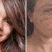 Juliana Garcia, espancada com 61 socos em elevador, mostra rosto uma semana após cirurgia facial. Agressor está preso por tentativa de feminicídio.
