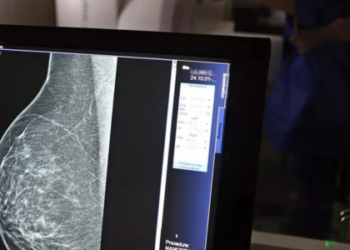 Mulheres de 40 a 49 anos agora podem realizar mamografia pelo SUS. Medida amplia rastreamento, oferece carretas de saúde e novos tratamentos contra o câncer de mama.