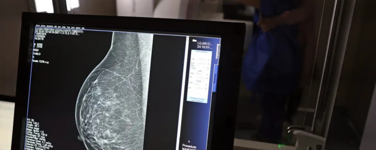 Mulheres de 40 a 49 anos agora podem realizar mamografia pelo SUS. Medida amplia rastreamento, oferece carretas de saúde e novos tratamentos contra o câncer de mama.