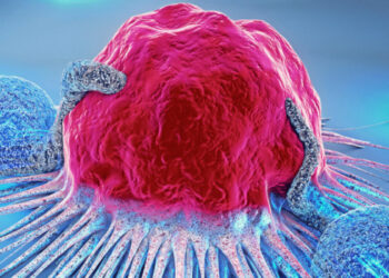 Estudo da The Lancet prevê aumento de quase 75% nas mortes por câncer até 2050, com 18,6 milhões de óbitos anuais e mais da metade dos novos casos em países de baixa e média renda.