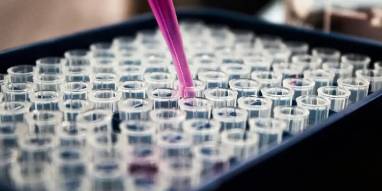 Pesquisadores brasileiros identificam proteína p-tau217 como marcador eficaz para diagnóstico precoce do Alzheimer por exame de sangue.