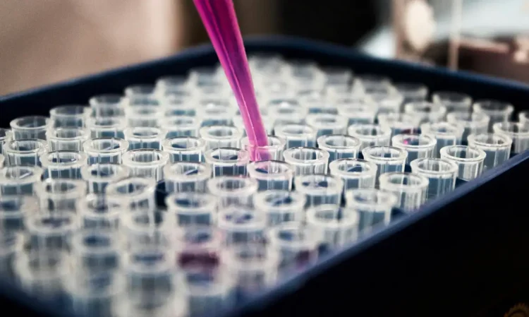 Pesquisadores brasileiros identificam proteína p-tau217 como marcador eficaz para diagnóstico precoce do Alzheimer por exame de sangue.