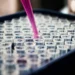 Pesquisadores brasileiros identificam proteína p-tau217 como marcador eficaz para diagnóstico precoce do Alzheimer por exame de sangue.